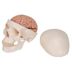 Human Skull, 3 Parts Numbered